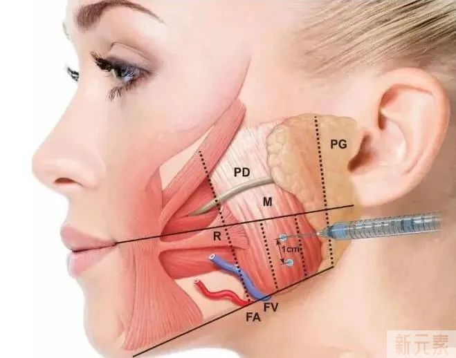 瘦脸之后竟然会出现这种情况?! 图片-5