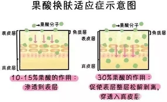 夏季爆痘不要慌，纯干货祛痘指南，轻松祛痘洁净肌肤! 图片-6