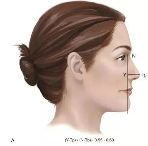 蒜头鼻、朝天鼻、鹰钩鼻...鼻头难看怎么破? 图片-6