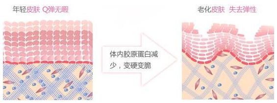 改善毛孔粗大有哪些医美项目可选择? 图片-2