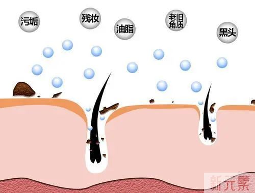 毛孔粗大的原因以及想改善毛孔该从哪下手? 图片-6