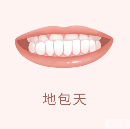 科普 | 地包天错过最佳治疗时机怎么办? 图片-2