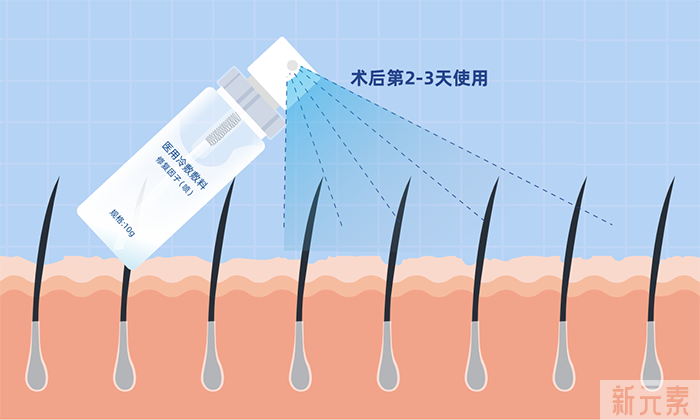 ​植发术后恢复时还会疼吗? 图片-3