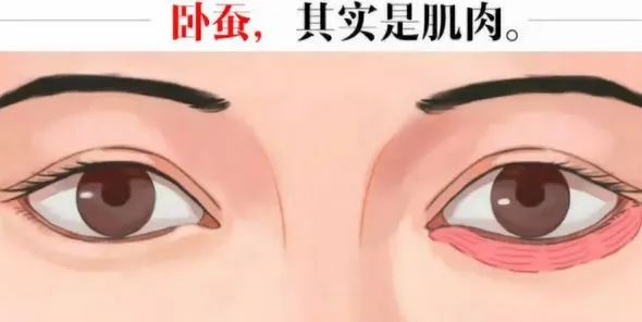 困扰无数女生的「眼袋智商税」，你都交了没? 图片-5