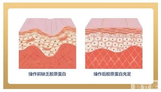 热玛吉这么火，谁都适合做吗? 图片-5