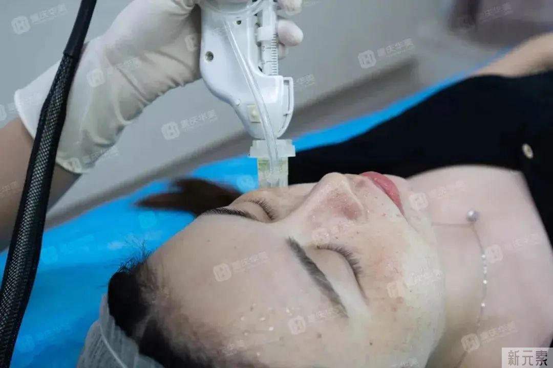 夏天不适合祛斑?这有什么讲究吗? 图片-5