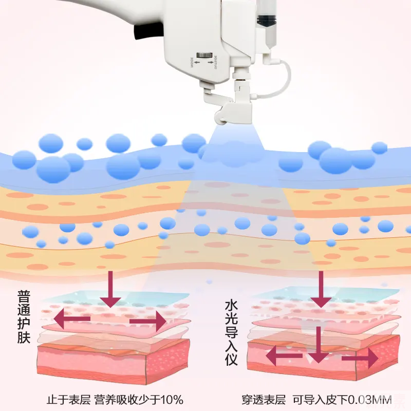 水光项目有啥用?疼不疼?能维持多久?关于水光，一篇讲清楚 图片-6