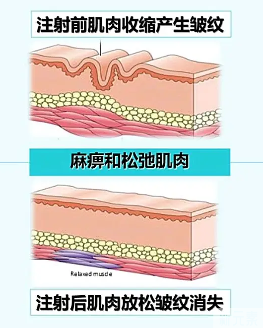 护肤不能只顾脸面，小心拖你后腿 图片-6