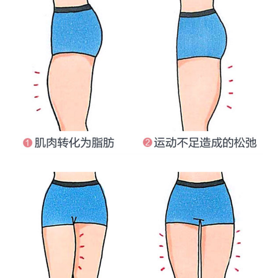 注射瘦腿和吸脂瘦腿的区别，你选对了吗? 图片-11