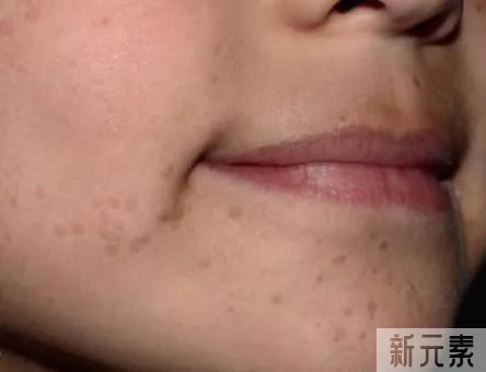 2022年第十六届【525全国护肤日】好皮肤的第一步:管好你的手 图片-5