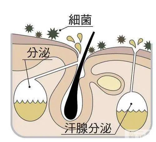 腋下疤痕的几种类型，看看你是哪一种? 图片-2