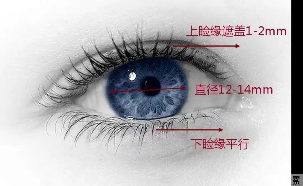 割双眼皮前，你需要做好这些攻略 图片-3