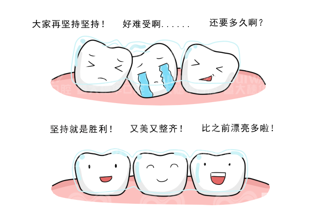 隐形牙套黏在牙齿上的“小凸点”到底有何用? 图片-3