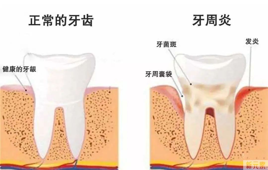 科普来了 | 牙痛了该怎么办?按照文中【干货处理方式】试试! 图片-5