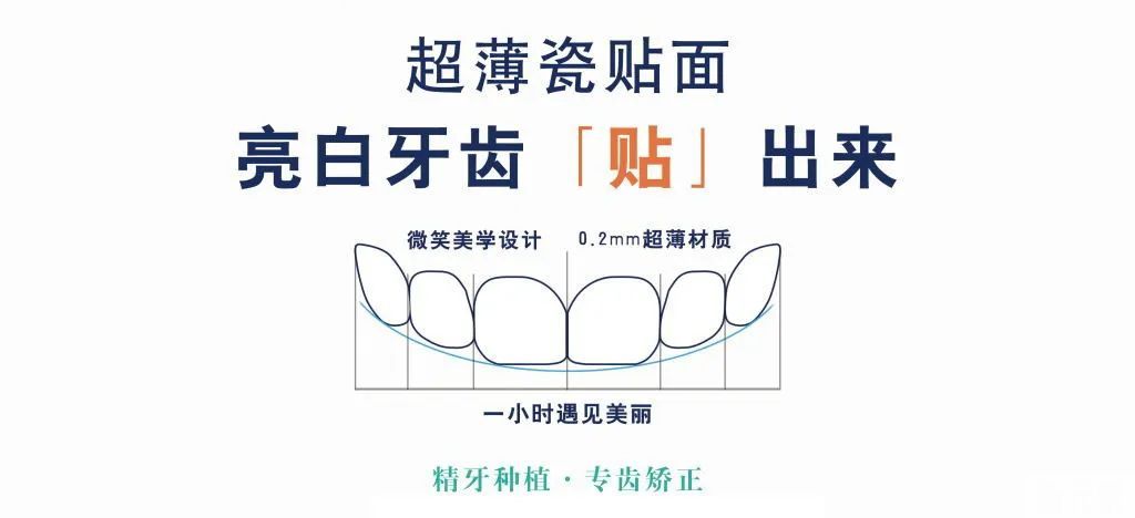 美白修复:牙齿贴面能维持多久呢? 图片-5