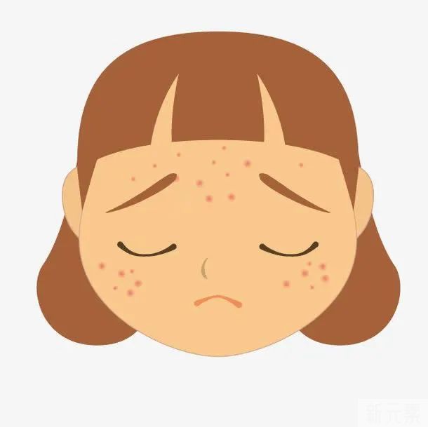 玫瑰痤疮是痤疮吗?治疗不同要注意... 图片-4