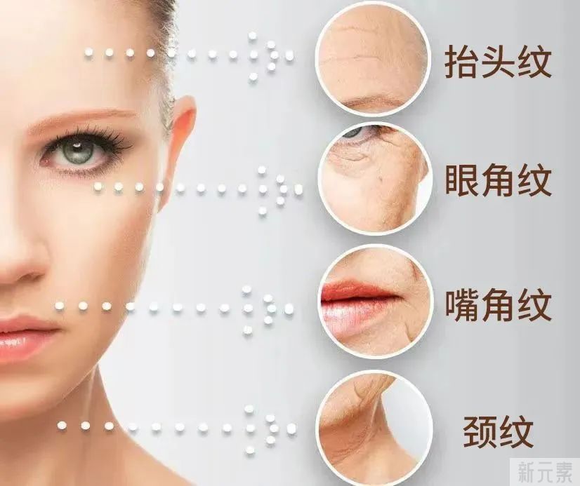 抗衰要趁早!面部抗衰逆龄的秘诀，你找对方法了吗? 图片-2
