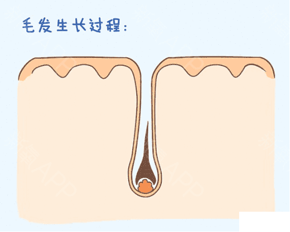 那些植发的人，最后头发都长茂密了吗? 图片-3