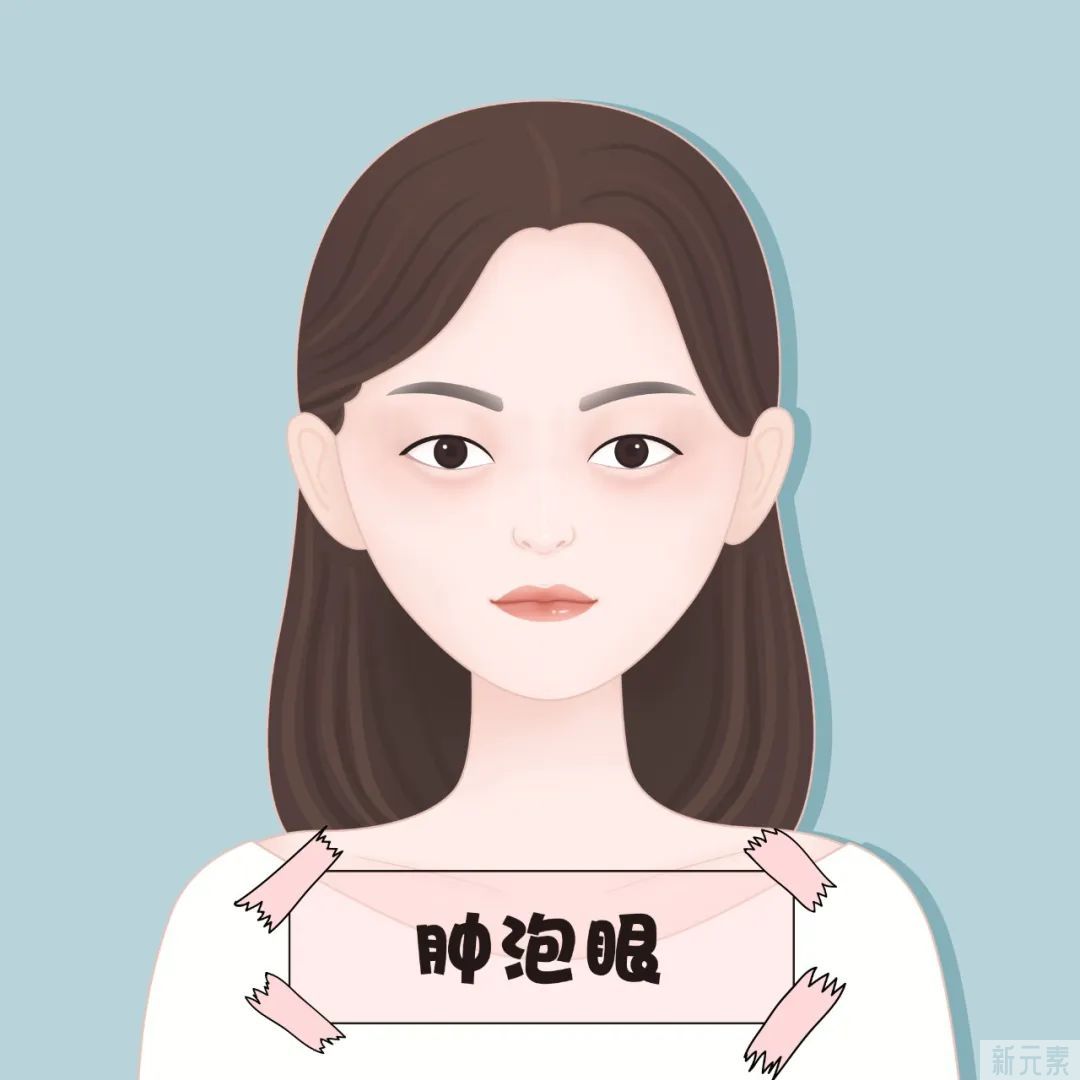 双眼皮自查，看你适合哪一种手术方式? 图片-2
