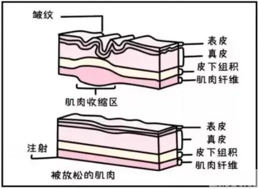 99%的女生都会遇到的“纹”题，早重视早年轻! 图片-5