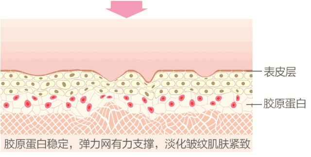 99%的女生都会遇到的“纹”题，早重视早年轻! 图片-7
