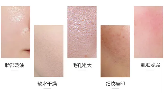 狂敷面膜补水，皮肤为什么不见好? 图片-1