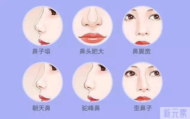 隆鼻前必看，如何拥有“妈生鼻”?关键做好这三点! 图片-4