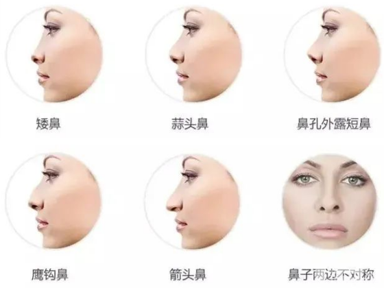 怎样才能做出一个好看的鼻子?这篇攻略请拿好! 图片-16
