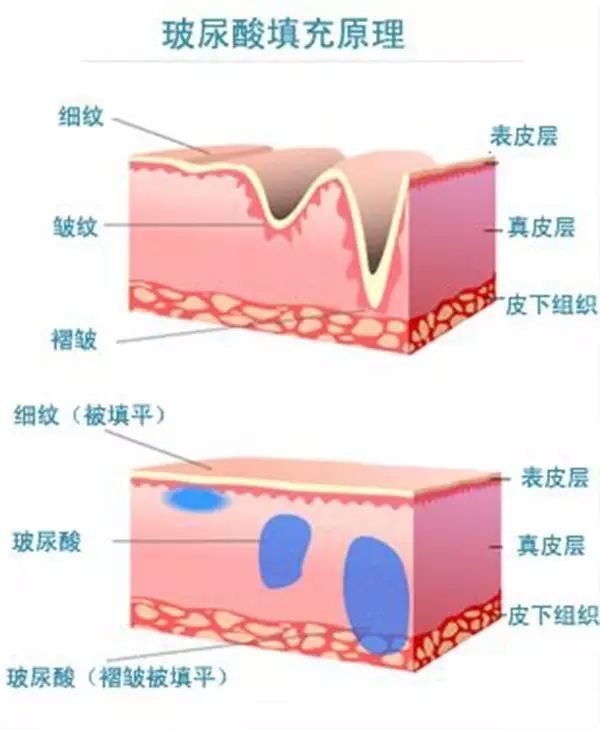 素颜美女的秘诀知道吗?了解这三点不会盲目担心 图片-12