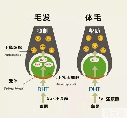 DHT和脱发之间的6种关系 图片-3