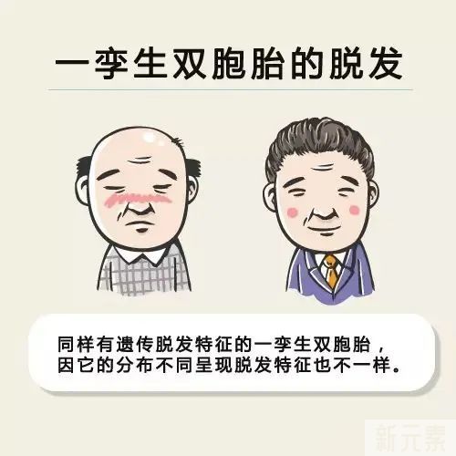 DHT和脱发之间的6种关系 图片-5