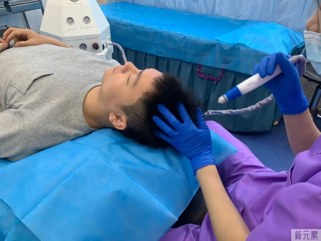 听说，药物治疗脱发有副作用? 图片-14