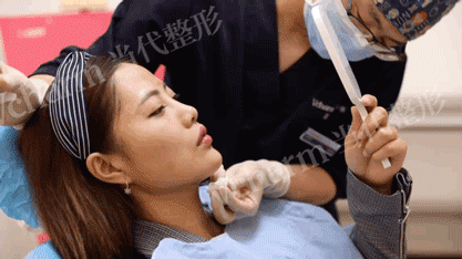 玻尿酸≠假面感，填充后更具高级感?! 图片-6