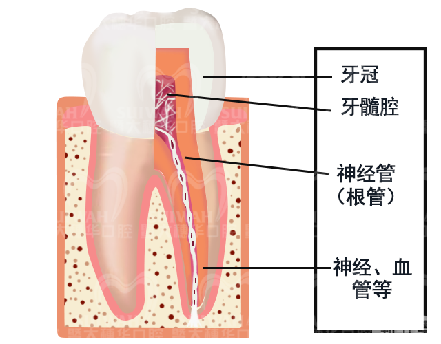 什么是显微根管?它与传统根管治疗有什么区别? 图片-6