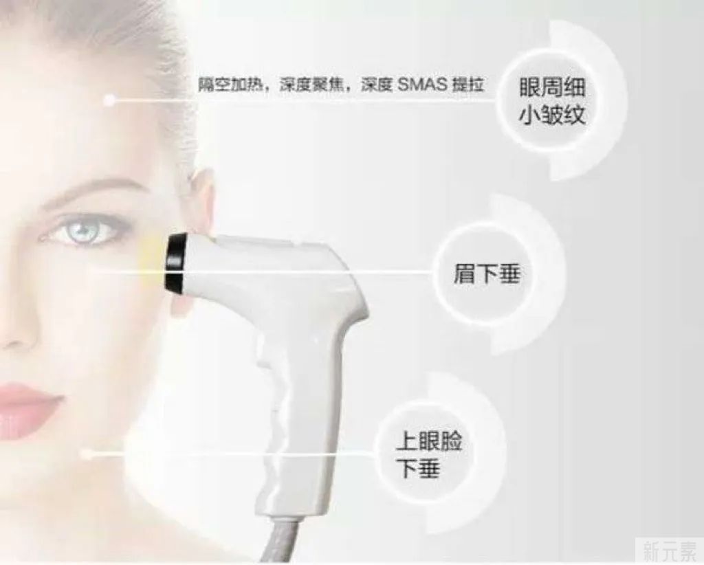 光电类的紧肤仪器会让皮肤变薄?NO!大错特错! 图片-9