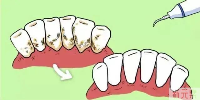 想让牙齿变白，竟这么简单吗? 图片-10