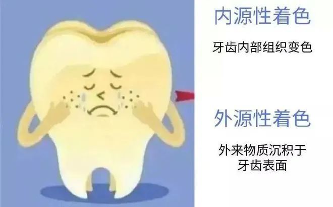 想让牙齿变白，竟这么简单吗? 图片-7
