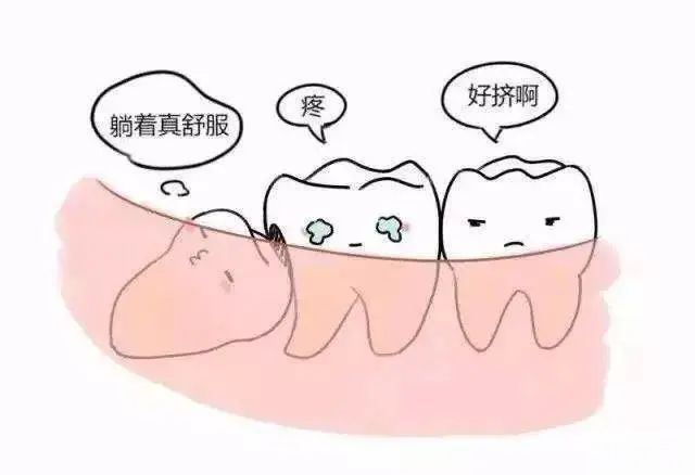 智齿总是发炎，什么时候拔更好? 图片-5