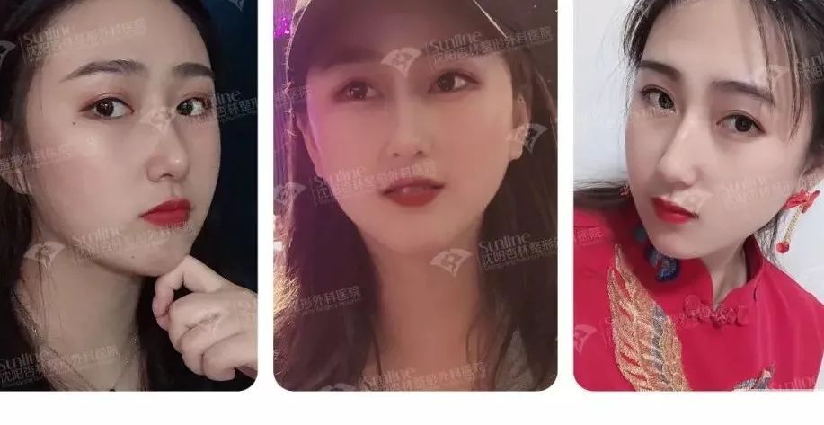 鼻综合的8大功效!你知道几个? 图片-4