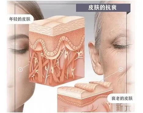 干货丨还在混淆热玛吉&热拉提?一篇帮你弄明白! 图片-3