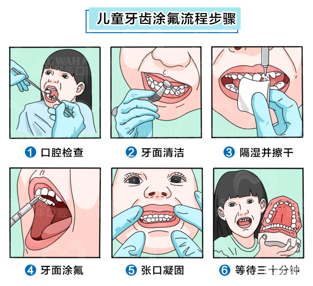 口腔体检报告看不懂?医生帮你“划重点”! 图片-6