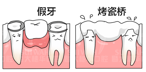 种一颗牙要上万块?种植牙的“内幕”你了解多少? 图片-3