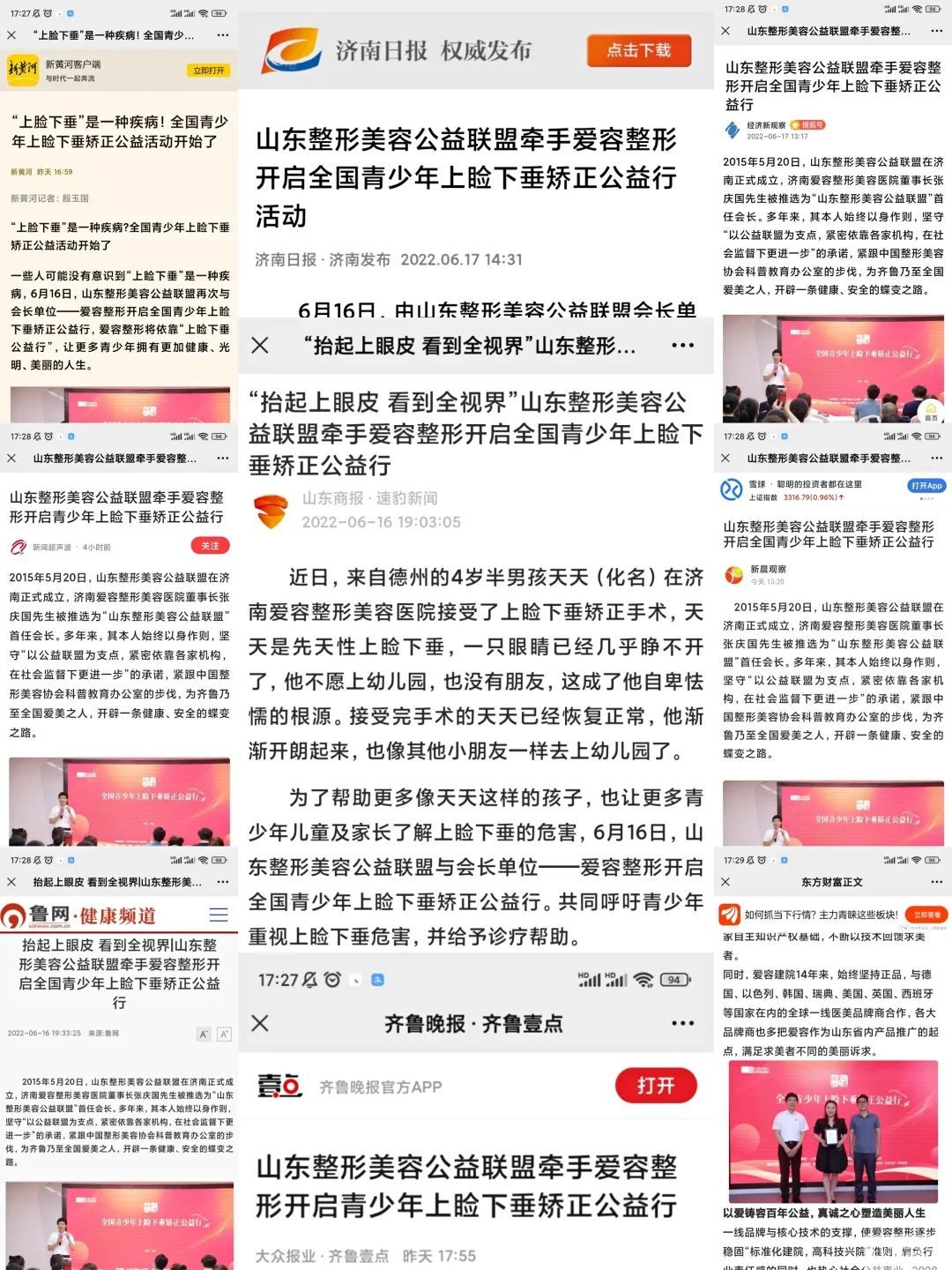 全国青少年上睑下垂矫正公益行启动，人民网、大众网、齐鲁网十余家为爱发声 图片-4