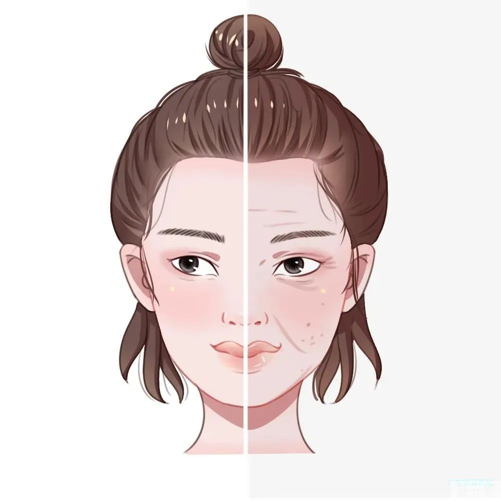 皮肤衰老的表现有哪些?如何延缓衰老? 图片-4