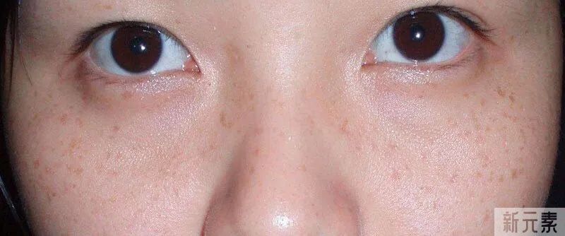 脸上有斑点，又是黑黄皮的宝子们，这两大项目直接给我安排上! 图片-8