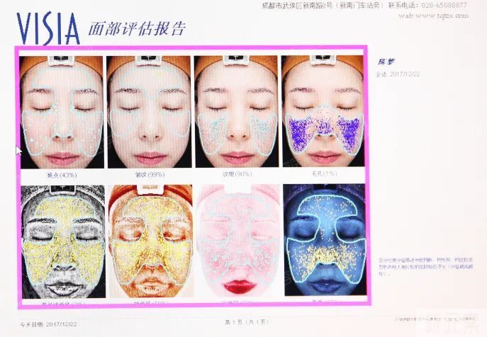 脸上有斑点，又是黑黄皮的宝子们，这两大项目直接给我安排上! 图片-15