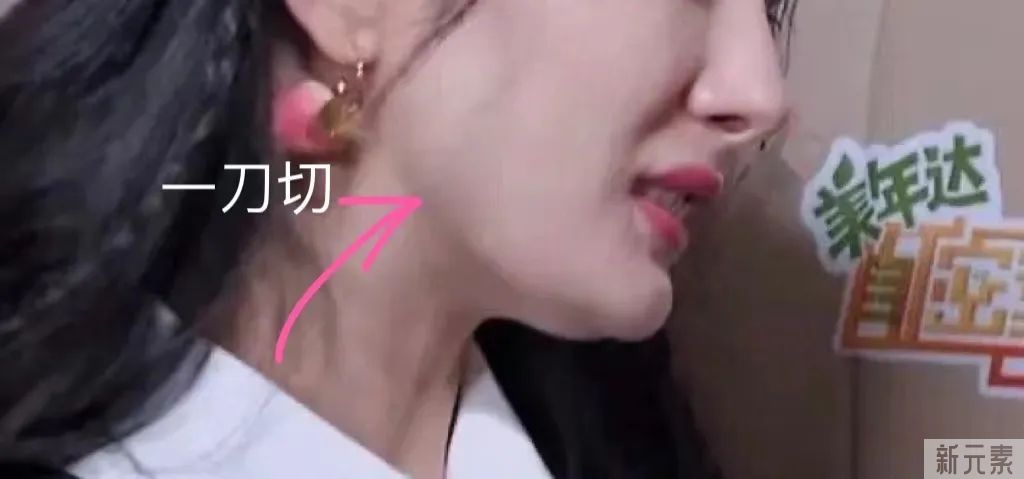 磨骨后一眼就能被识破?5个关于磨骨的误区，骗了多少人~ 图片-3
