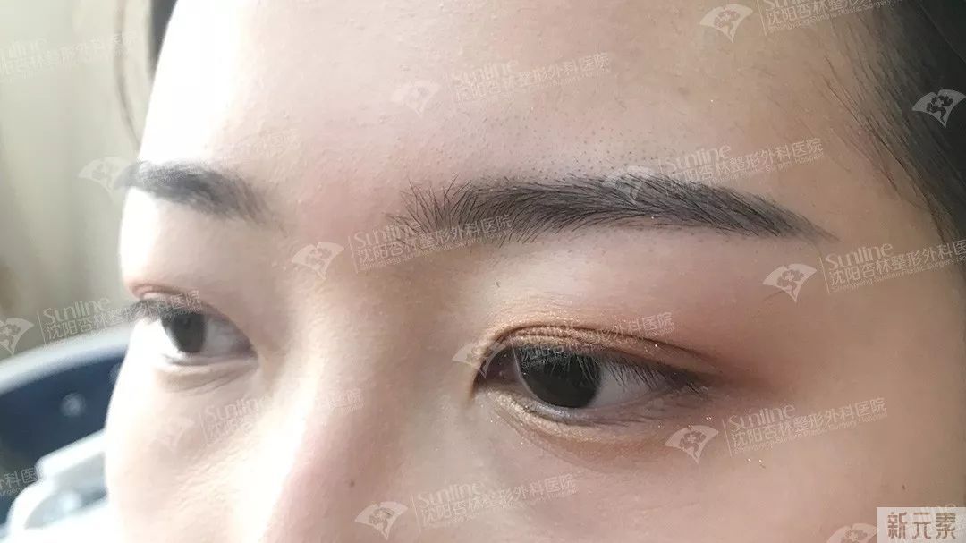 半永久纹绣必须要补色吗? 图片-8