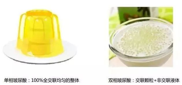 400元以内预算，选哪种玻尿酸好? 图片-18