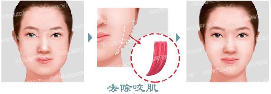 为了瘦脸你交过多少智商税? 图片-3